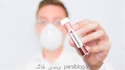 احتمال آلودگی یك آزمایشگاه سازنده كیت های تست كروناویروس در آمریكا